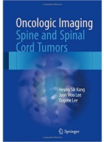 Oncologic Imaging: Spine and Spinal Cord Tumors