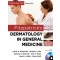 Fitzpatrick's Dermatology in General Medicine, 8/e