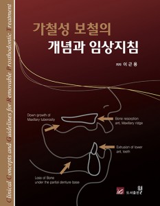 가철성 보철의 개념과 임상지침 - Clinical Concepts and Guidelines for Removable Prosthodontic Treatment