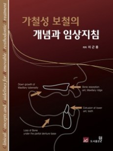 가철성 보철의 개념과 임상지침 - Clinical Concepts and Guidelines for Removable Prosthodontic Treatment