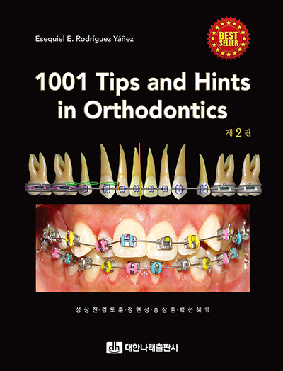 1001 Tips and Hints in Orthodontics 제2판 