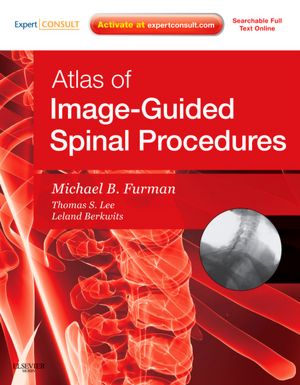 Atlas of Image-Guided Spinal Procedures