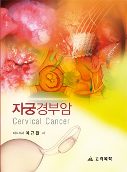 자궁경부암:Cervical Cancer 