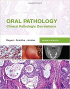 Oral Pathology: Clinical Pathologic Correlations, 7e  