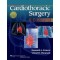 Cardiothoracic Surgery Review