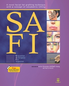 SAFI-English ver. (Sequential Autologous Fat Injection)