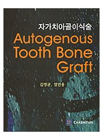 자가치아골이식술 - Autogenous Tooth Bone Graft -