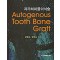 자가치아골이식술 - Autogenous Tooth Bone Graft -