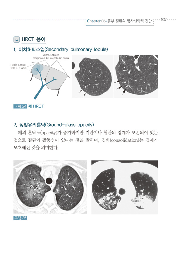 호흡기학 Manual