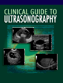 Clinical Guide to Ultrasonography 