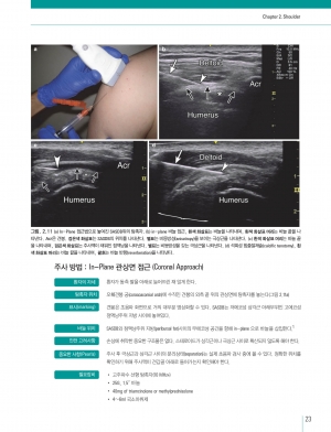 초음파를이용한 근골격계 주사치료의모든것