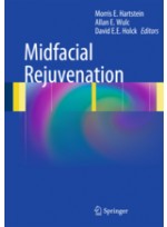 Midfacial Rejuvenation