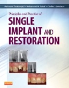 Principles and Practice of Single Implant and Restoration  