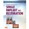 Principles and Practice of Single Implant and Restoration  