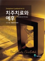 치주치료와 예후(덴트포토 케이스북 Vol.01)