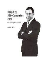 매혹적인 All-Ceramic의 세계  