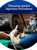 Ultrasono-Guided injection 상지편---CD 1장