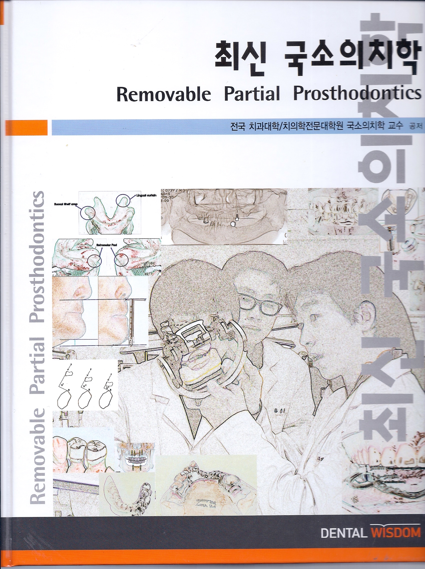 최신국소의치학 Removable Partial Prosthodontics