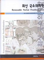 최신국소의치학 Removable Partial Prosthodontics