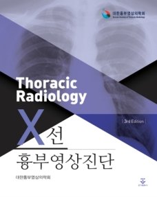 흉부영상진단X선 (3판)