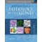 Heptinstall's Pathology of the Kidney,7/e