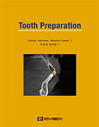 Tooth Preparation 