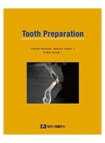 Tooth Preparation 