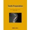 Tooth Preparation 