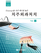 Concept을 가진 예지성 높은 치주외과처치 제2판 Vol.I  