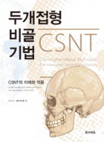 두개접형비골기법-CSNT의 이해와 적용