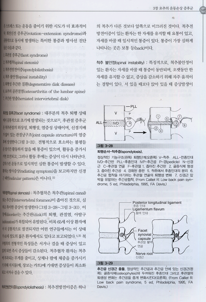 운동손상 증후군의 진단과 치료