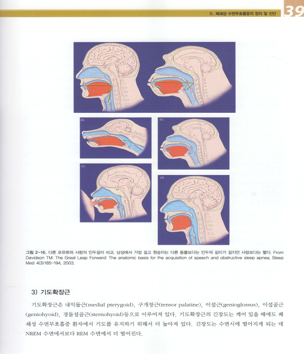 코골이 및 수면무호흡증의 구강장치 치료(Oral Appliance Therapy for Snoring & OSA)