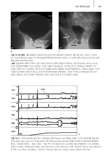 요역동학검사 아틀라스, (Urodynamics,UDS)