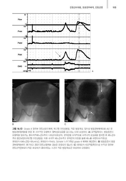 요역동학검사 아틀라스, (Urodynamics,UDS)