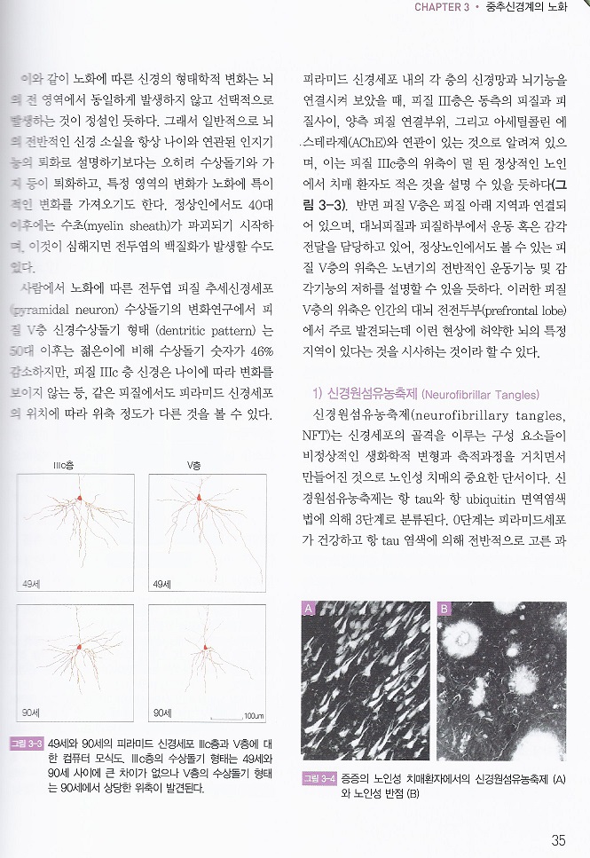 노인 재활의학