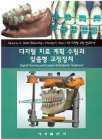 디지털 치료 계획 수립과 맞춤형 교정장치 