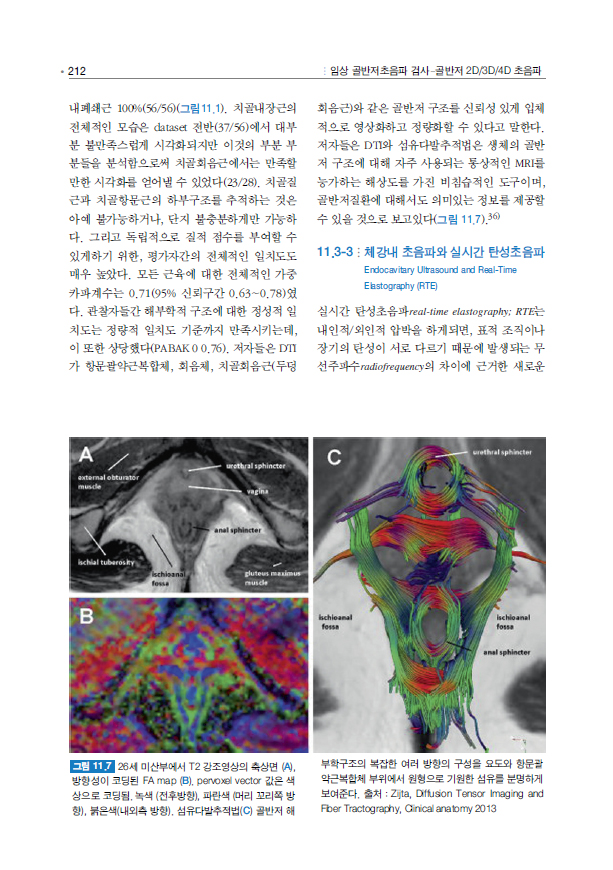 임상 골반저초음파 검사 (골반저 2D/3D/4D 초음파 - 기초부터 응용까지)  