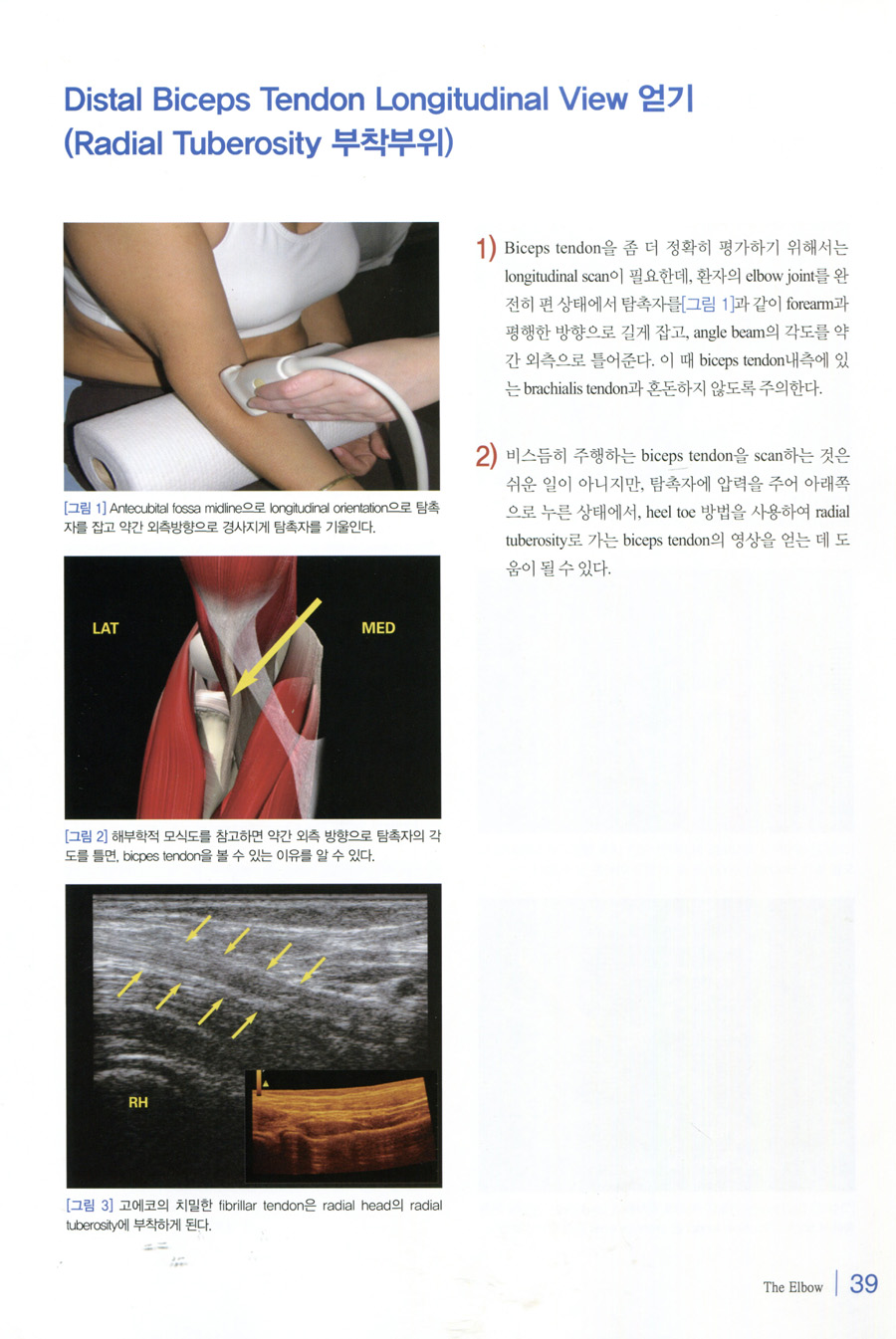 쉽게 익히는 근골격계 초음파(A Practical Guide to Sonography of the Extremities)