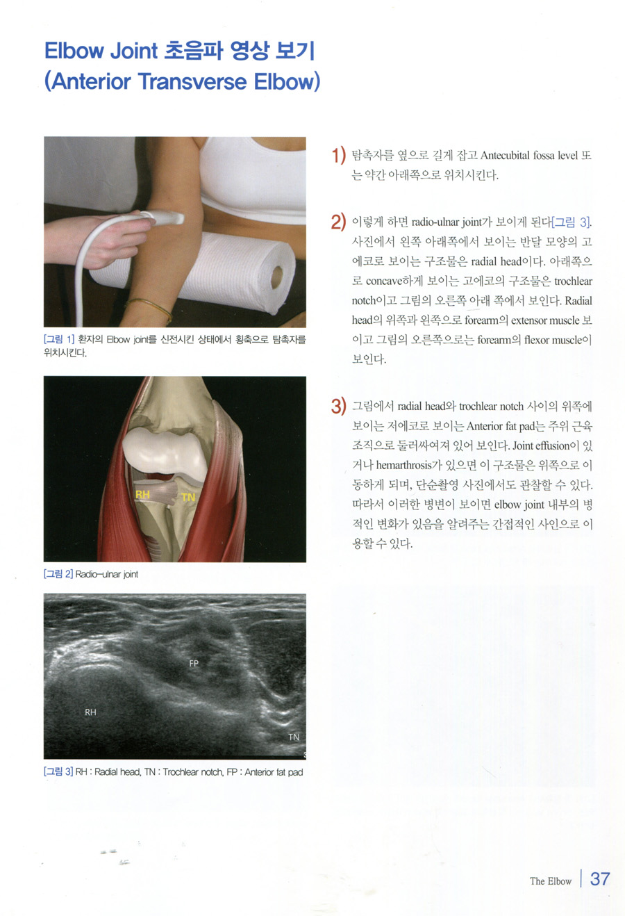 쉽게 익히는 근골격계 초음파(A Practical Guide to Sonography of the Extremities)