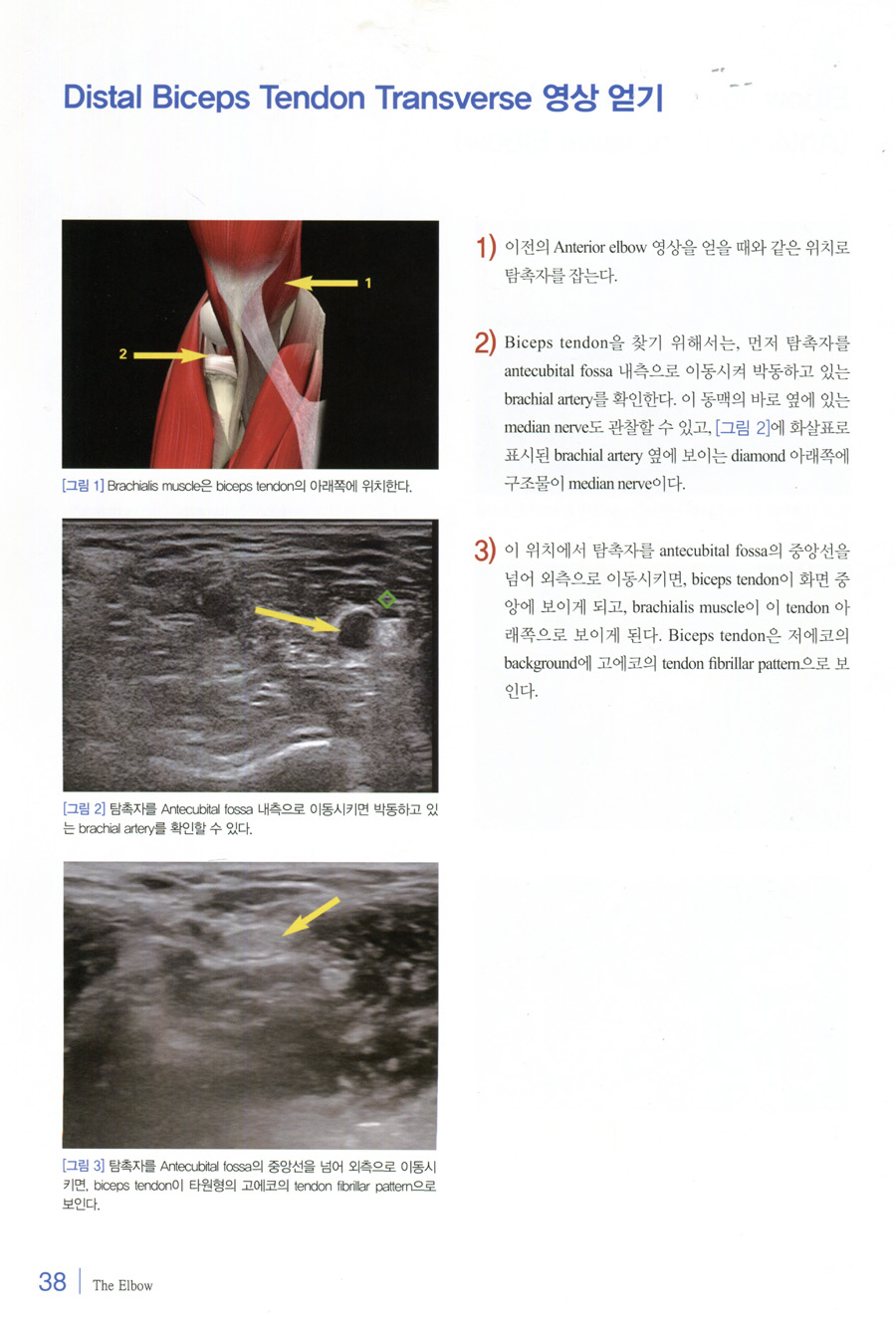 쉽게 익히는 근골격계 초음파(A Practical Guide to Sonography of the Extremities)