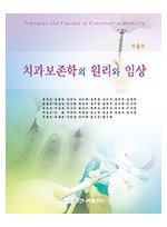 치과보존학의 원리와 임상 제4판 