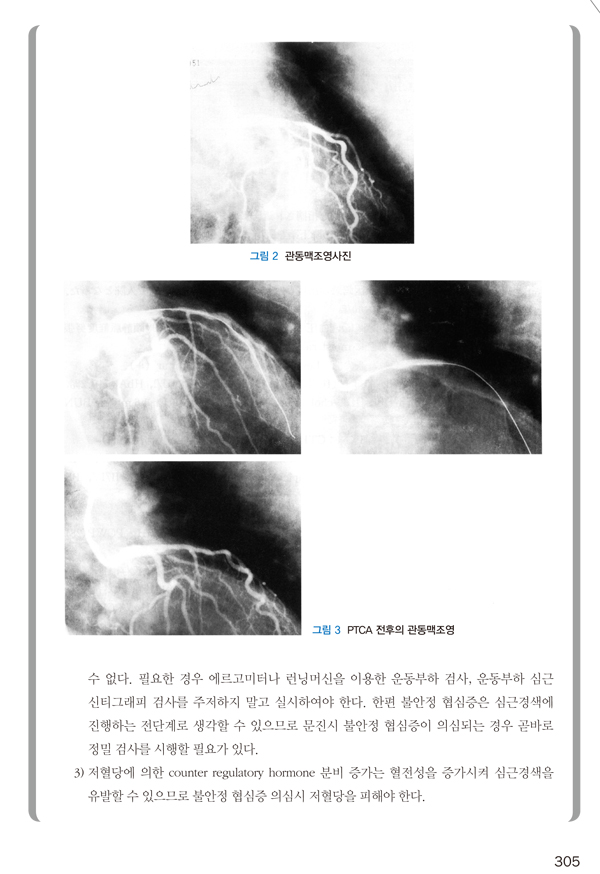 당뇨병 치료 이럴 땐 이렇게 - 100가지 상황의 대처