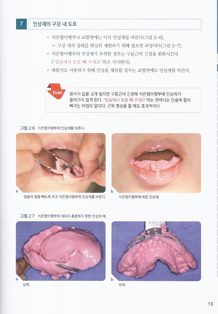 전공의와 젊은 치과의사를 위한 보철임상의 첫걸음