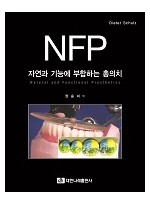  NFP 자연과 기능에 부합하는 총의치  