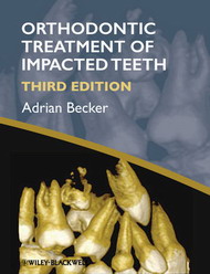 Orthodontic Treatment of Impacted Teeth, 3rd 