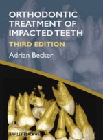 Orthodontic Treatment of Impacted Teeth, 3rd 