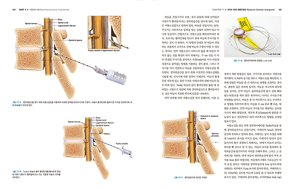 통증의학의 정석 (Fundamentals of Pain Medicine How to Diagnose and Treat Your Patients)