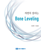 자연치 살리는 Bone Leveling  