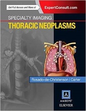 Specialty Imaging: Thoracic Neoplasms, 1e