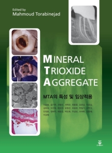 MTA의 특성 및 임상 적용